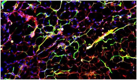 Science子刊：鉴定出血管是糖尿病的治疗靶标