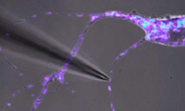 Cell Rep：突破！科学家阐明单个线粒体的首个DNA序列