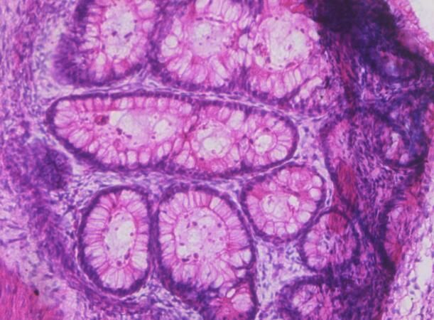 Cell Stem Cell：科学家利用畸胎瘤成功衍生出<font color='red'>肌肉</font>干细胞