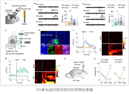PO参与组织损伤相关的异常性疼痛