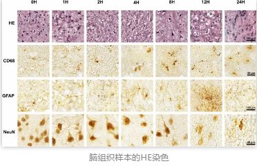 脑组织样本的HE染色