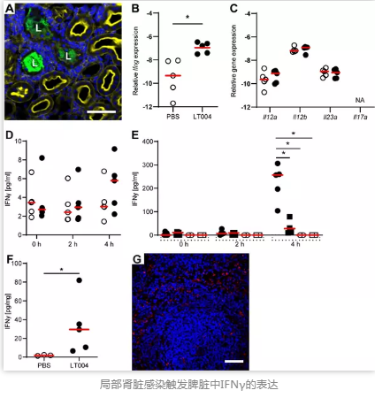局部肾脏感染触发脾脏中IFN&gamma;的表达