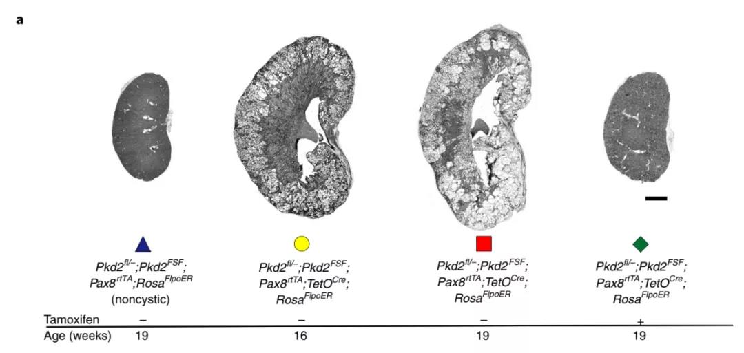 图注：晚期Pkd2再激活可逆转囊肿的形成，但肾脏修复不完全