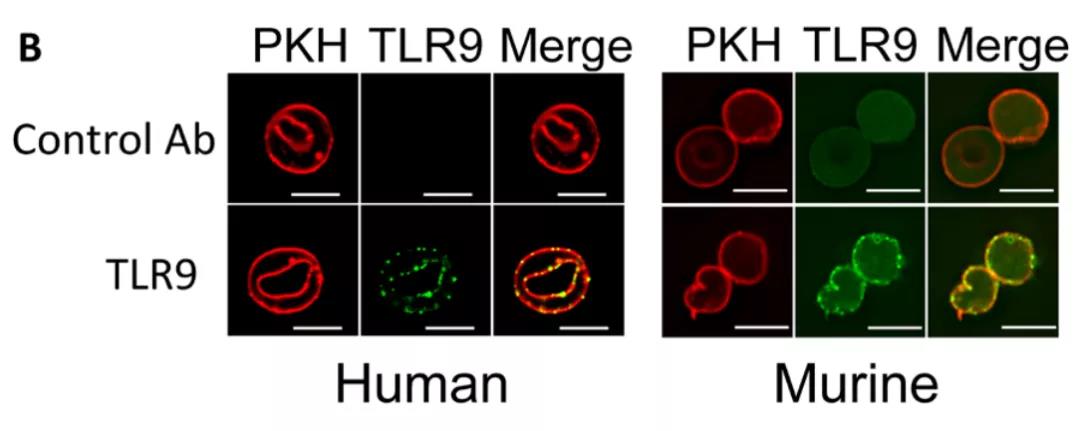 图注：研究者们分别利用荧光标记了细胞膜（绿色）和TLR9（红色）证明了人和小鼠体内TLR9在红细胞膜上的表达，人和小鼠红细胞膜上的TLR9表达