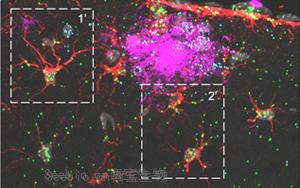 《Nature Neuroscience》可增强神经胶质细胞的蛋白质