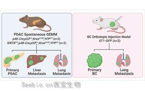 Nature子刊：一种帮助癌细胞扩散到全身的基因