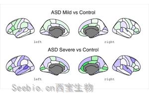 自闭症最早的生物学迹象