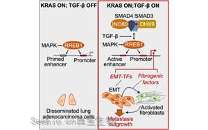 《Cell》新发现肺癌转移的关键信号通路