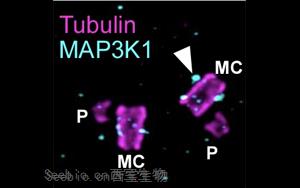 Cell子刊：2种中心体相关蛋白质不为人知的新功能
