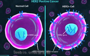 《自然医学》：一种可以显著延长乳腺癌患者生命的新药