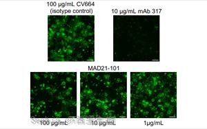 Science：一类全新的抗疟疾抗体