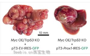 《Nature Genetics》PROX1积极抑制细胞命运可塑性，保护肝细胞身份，防止肝肿瘤发生